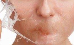 Cildine bunu yapanlar yandı! Cildiniz yanabilir…