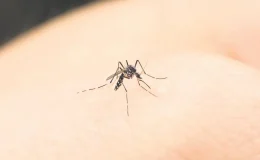 Sivrisinek ısırıkları için 5 doğal çözüm