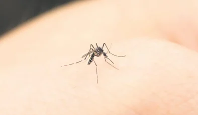 Sivrisinek ısırıkları için 5 doğal çözüm